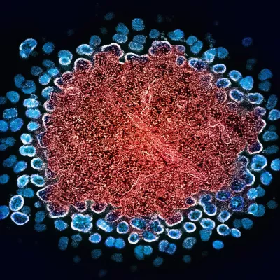Microscopic view of HIV-1 virus particles