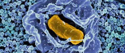 Electron micrograph of Salmonella Typhimurium invading a human epithelial cell