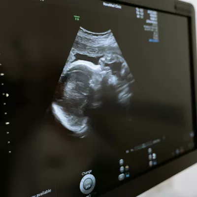 an ultrasound of an unborn fetus